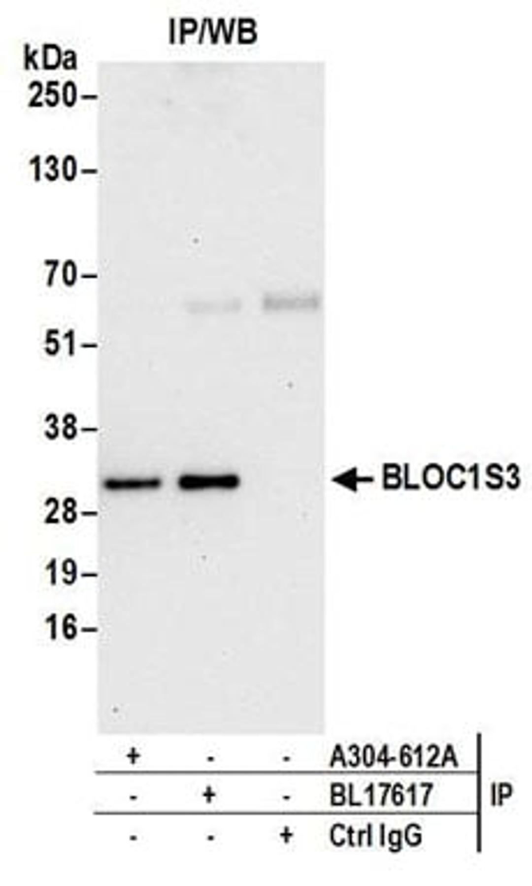 Detection of human BLOC1S3 by western blot of immunoprecipitates.