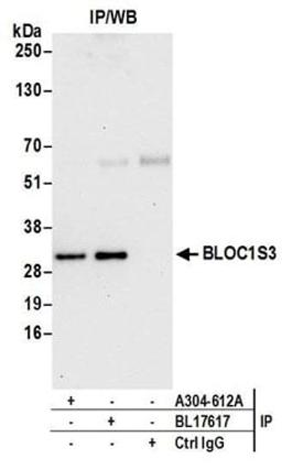 Detection of human BLOC1S3 by western blot of immunoprecipitates.