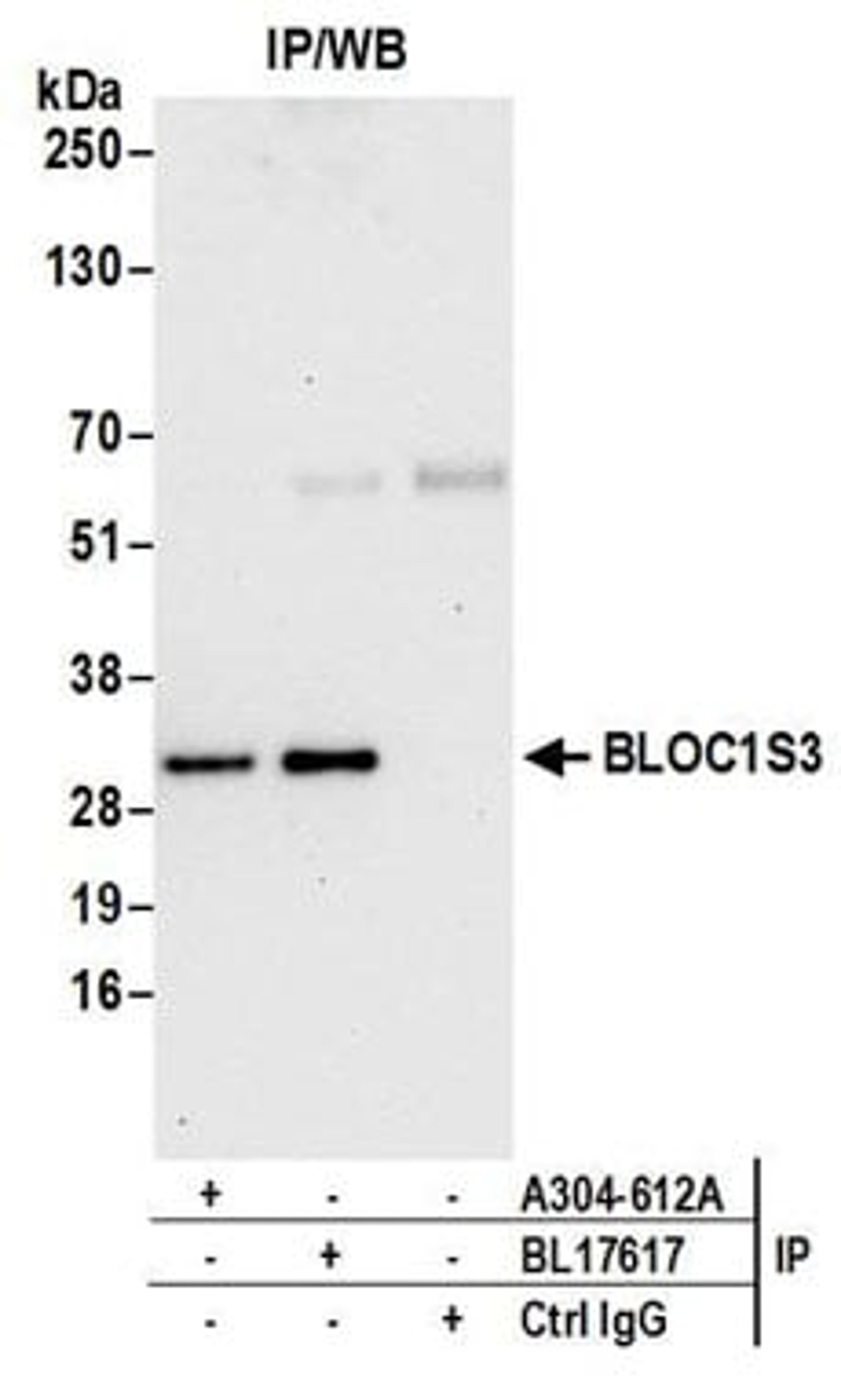 Detection of human BLOC1S3 by western blot of immunoprecipitates.