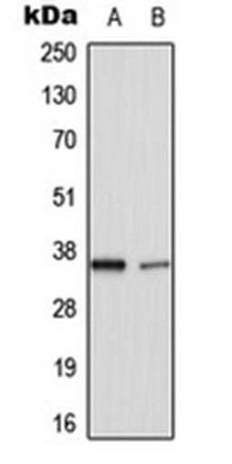 Western blot analysis of HuvEC (Lane 1), rat lung (Lane 2) whole cell lysates using TNFAIP1 antibody