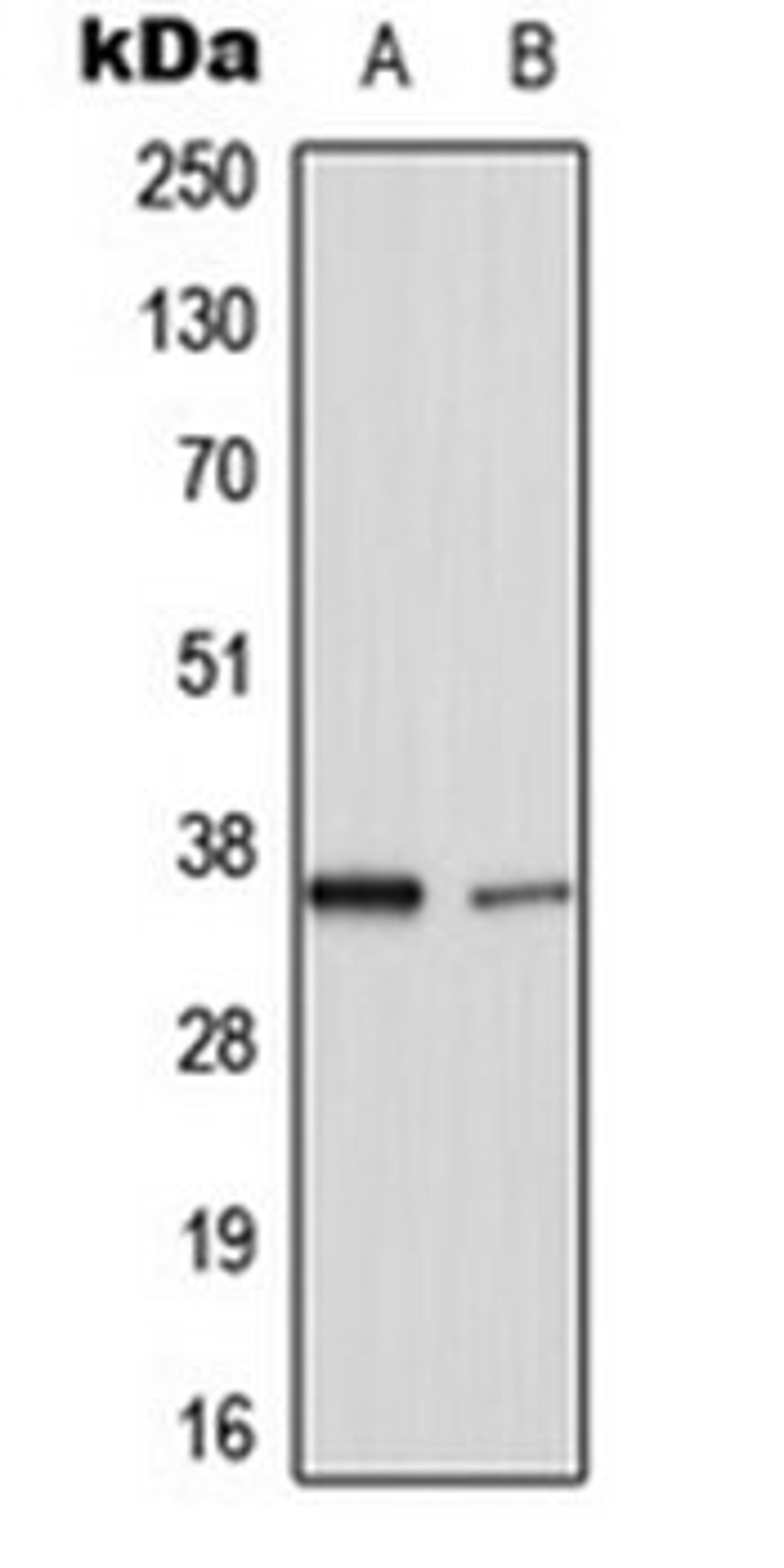 Western blot analysis of HuvEC (Lane 1), rat lung (Lane 2) whole cell lysates using TNFAIP1 antibody