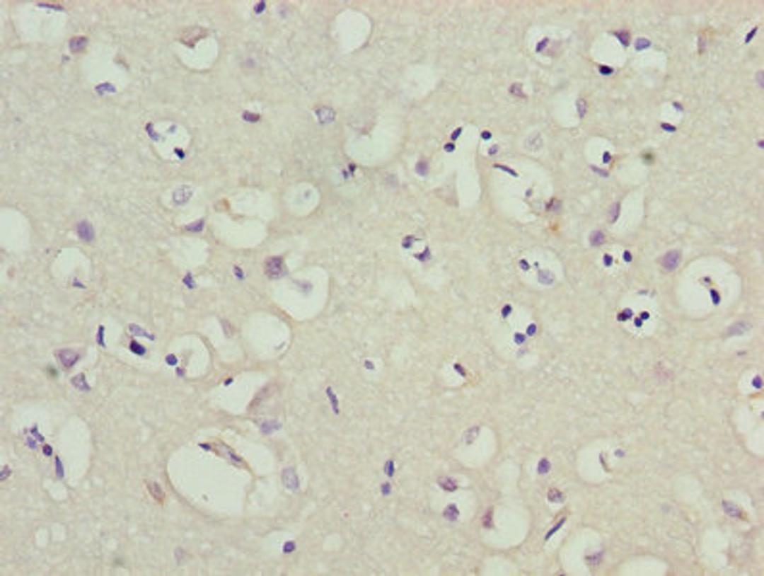 Immunohistochemistry of paraffin-embedded human brain tissue using CSB-PA012022LA01HU at dilution of 1:100
