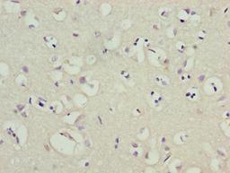 Immunohistochemistry of paraffin-embedded human brain tissue using CSB-PA012022LA01HU at dilution of 1:100