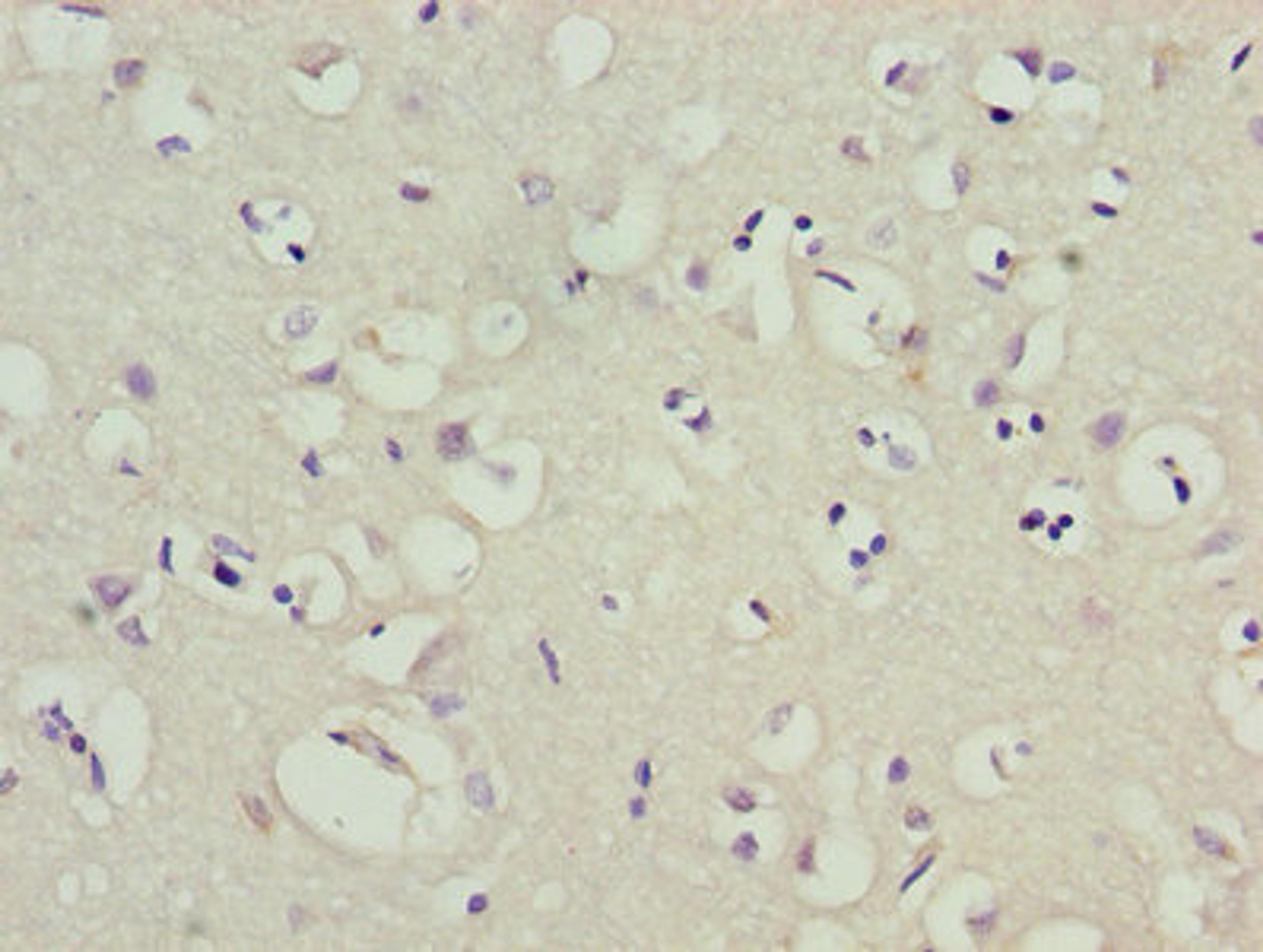 Immunohistochemistry of paraffin-embedded human brain tissue using CSB-PA012022LA01HU at dilution of 1:100