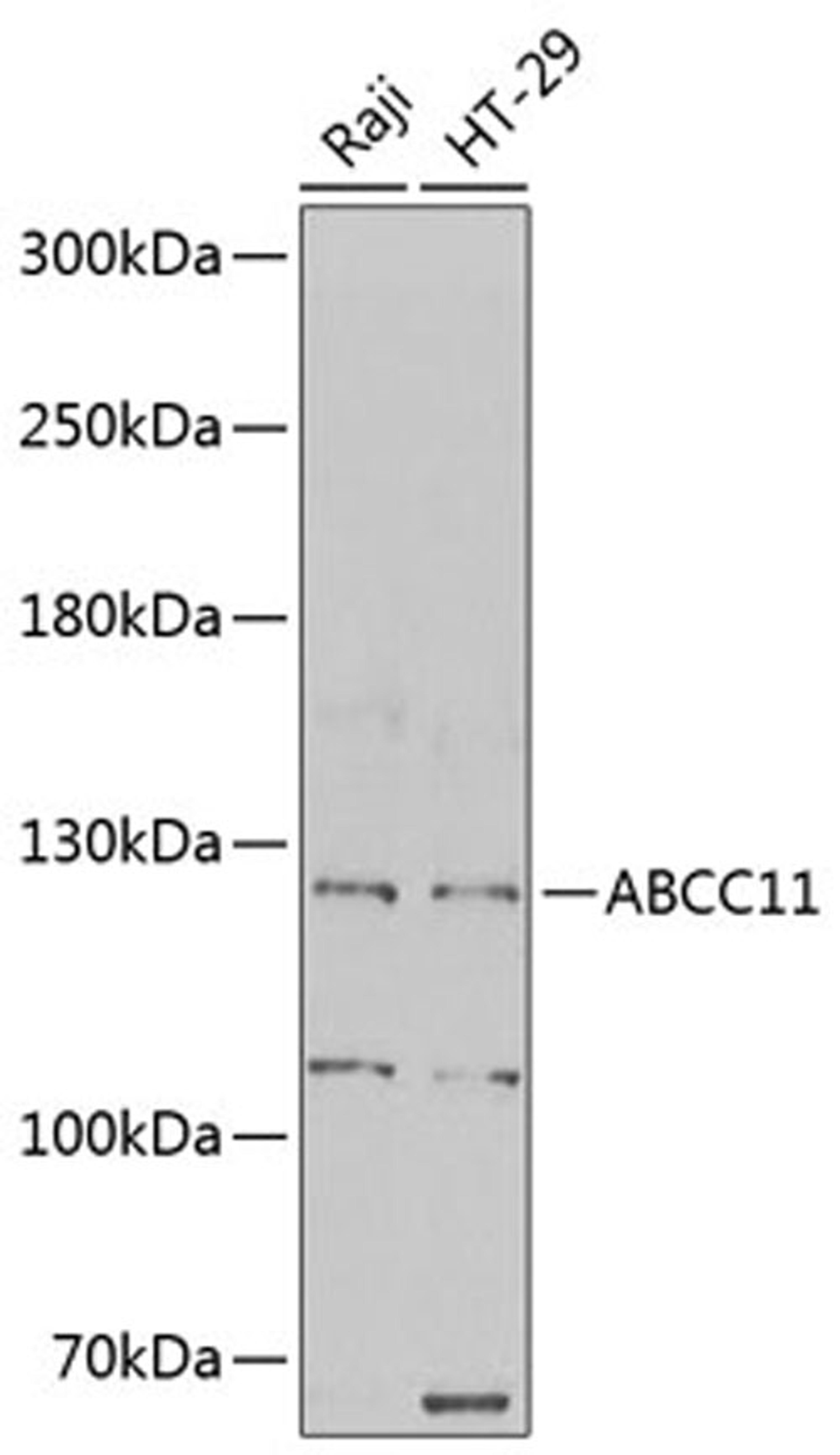 Western blot - ABCC11 antibody (A6514)