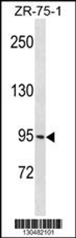 Western blot analysis in ZR-75-1 cell line lysates (35ug/lane).