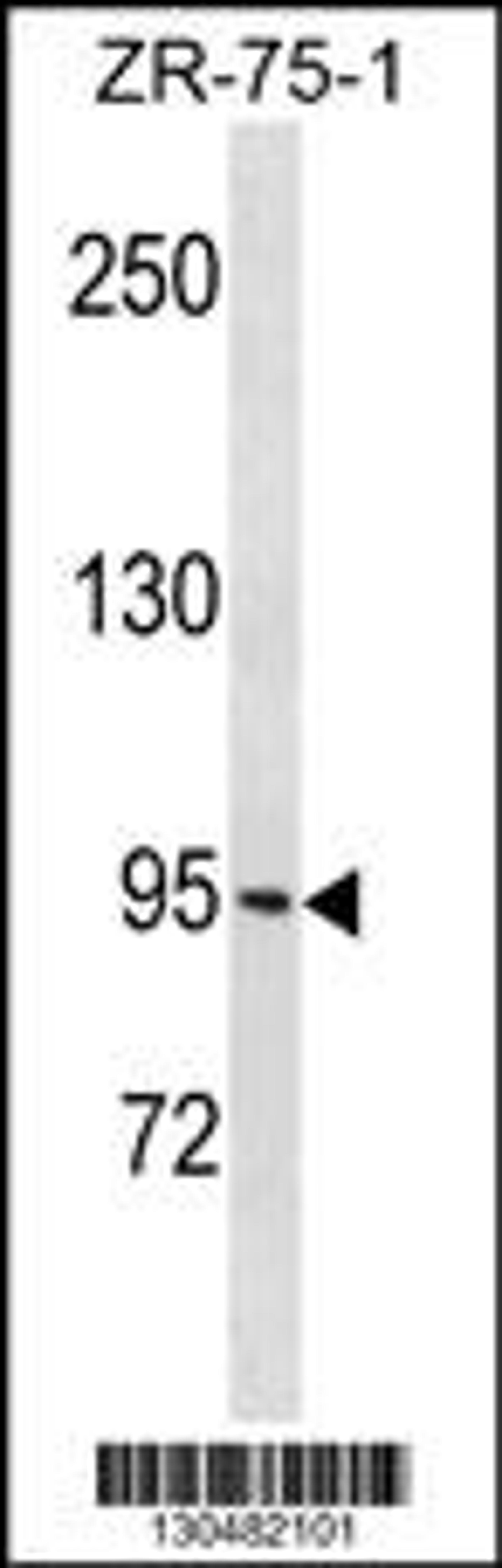 Western blot analysis in ZR-75-1 cell line lysates (35ug/lane).