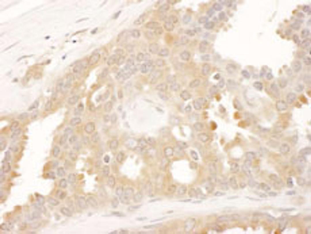 Detection of human CCT8 by immunohistochemistry.