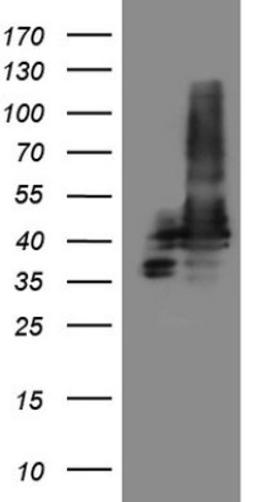 Immunohistochemistry: SLP-2 Antibody (1F5) [NBP2-45464] - Analysis of HEK293T cells were transfected with the pCMV6-ENTRY control (Left lane) or pCMV6-ENTRY SLP-2.