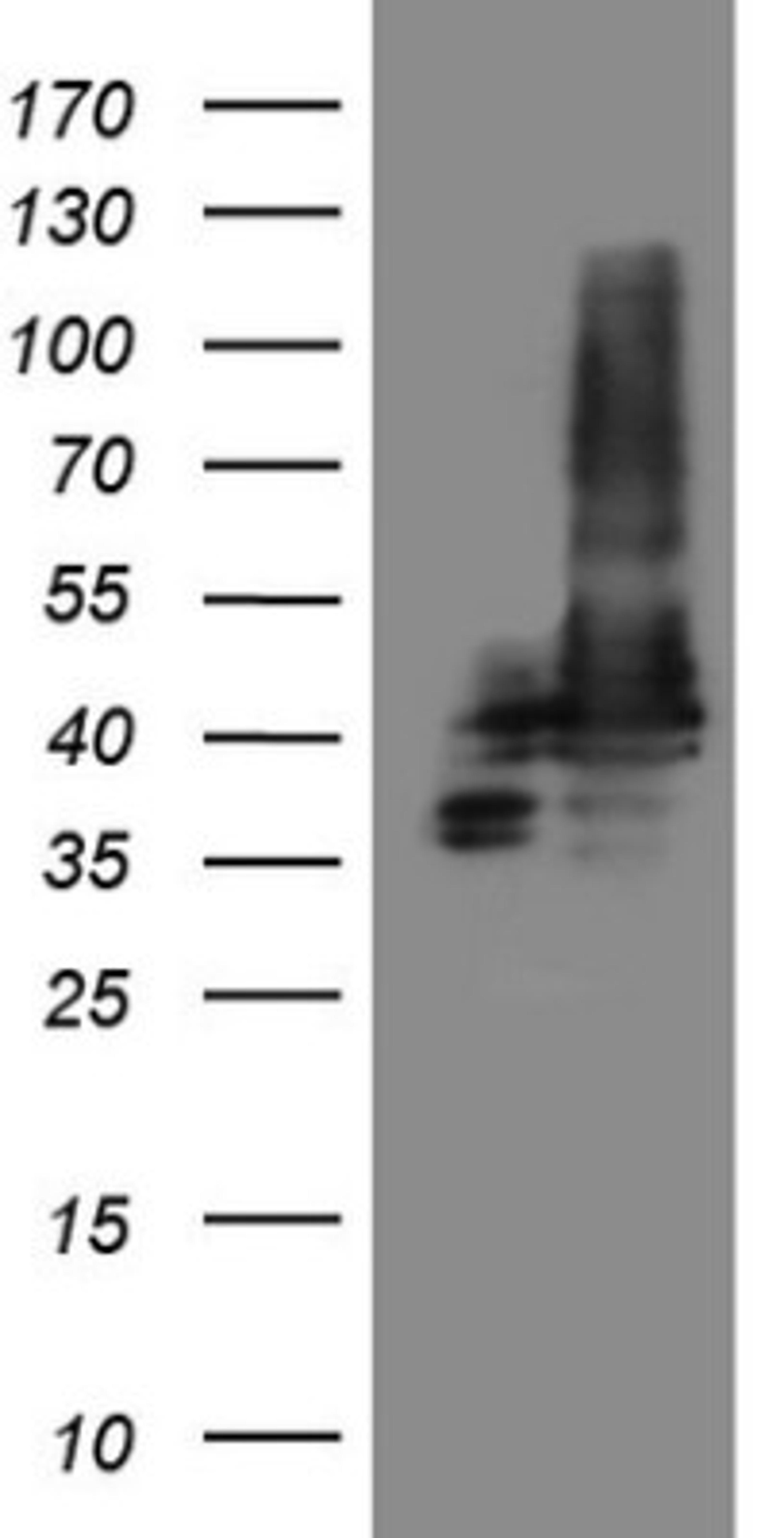 Immunohistochemistry: SLP-2 Antibody (1F5) [NBP2-45464] - Analysis of HEK293T cells were transfected with the pCMV6-ENTRY control (Left lane) or pCMV6-ENTRY SLP-2.