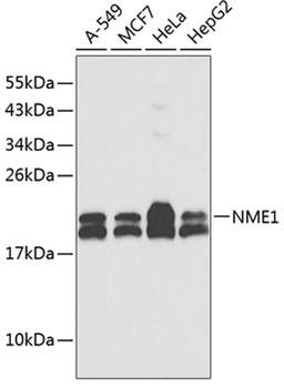 Western blot - NME1 antibody (A0259)