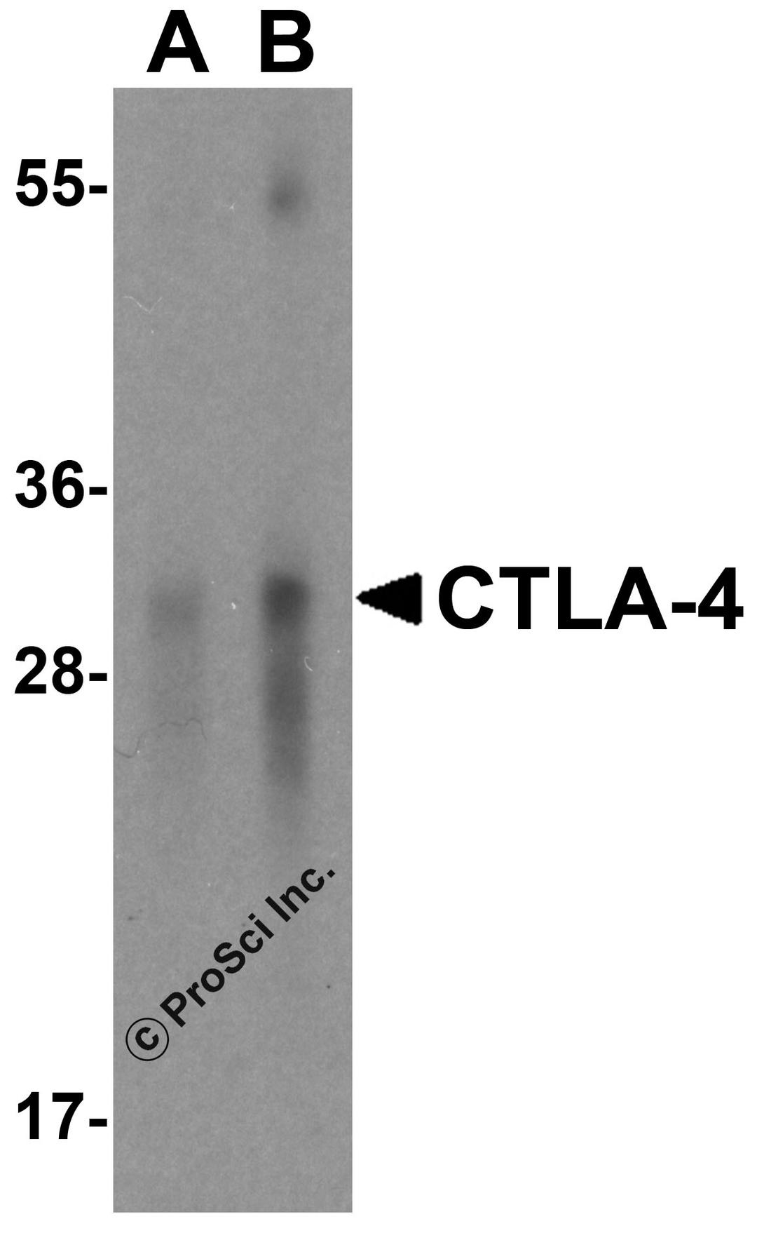 Western blot analysis of CTLA-4 in overexpressing HEK293 cells CTLA-4 antibody at 0.5 and 1 &#956;g/mL.