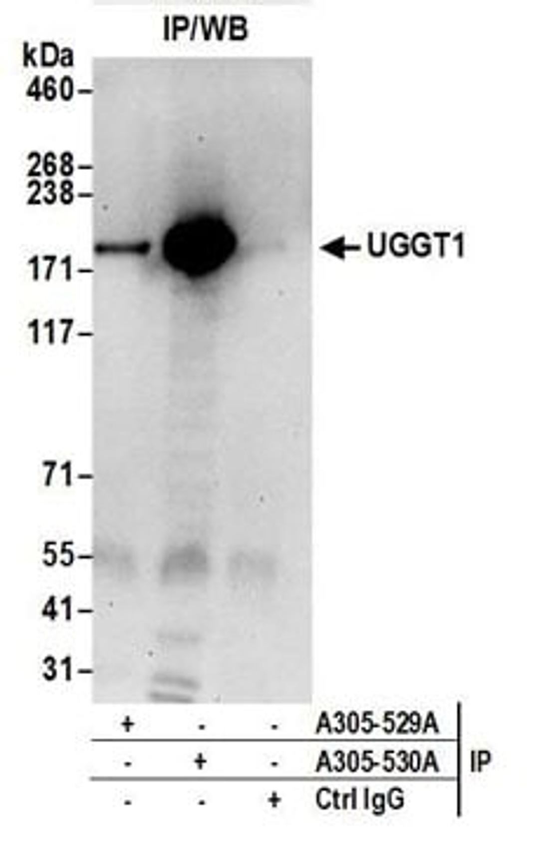 Detection of human UGGT1 by western blot of immunoprecipitates.