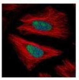 Immunocytochemistry/Immunofluorescence: Exosome component 10 Antibody [NBP1-32870] - Antibody (Green) at 1:500 dilution. Alpha-tubulin filaments were labeled with NBP1-33273 (Red) at 1:2000.