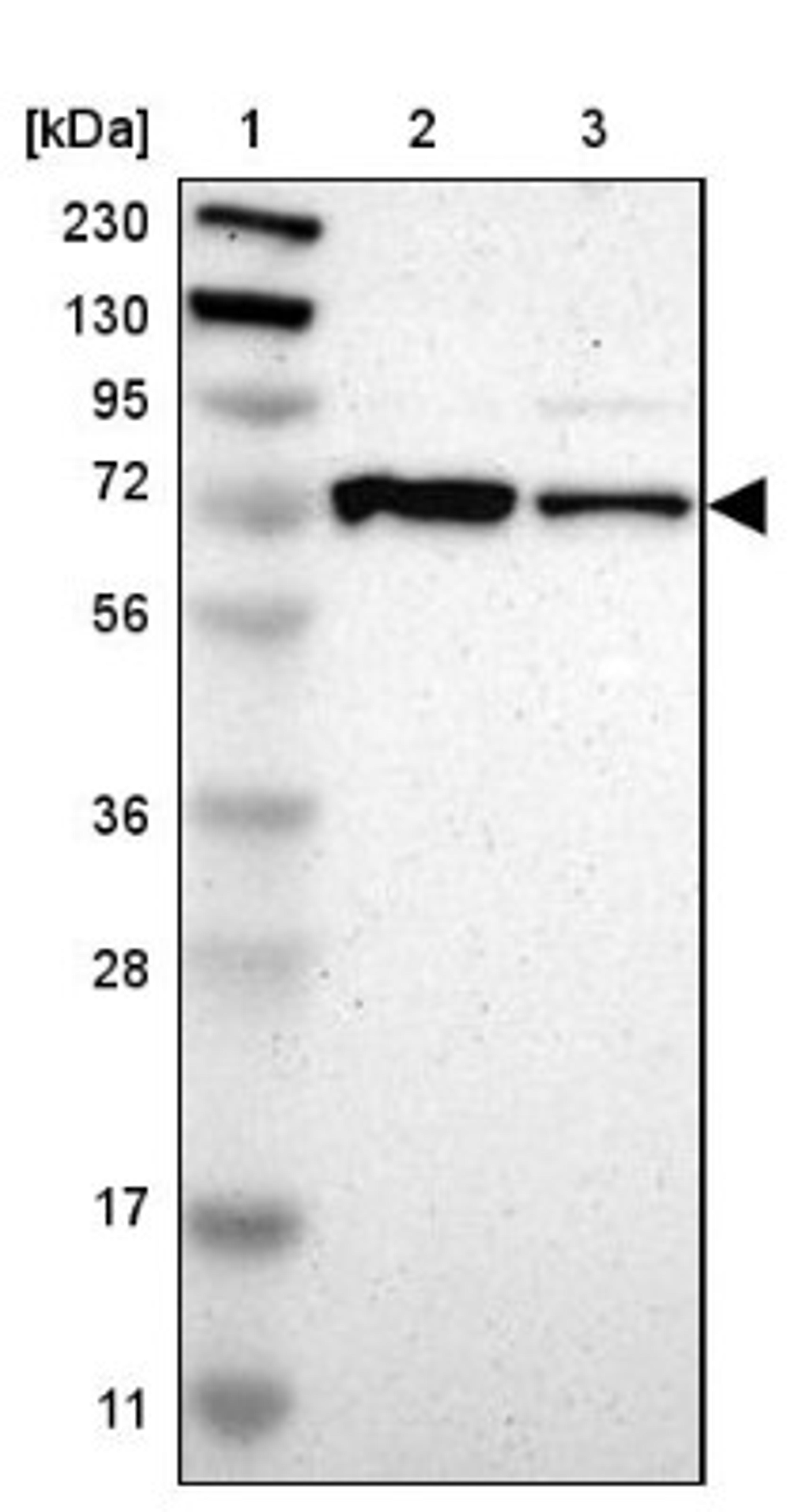 Western Blot: GPD2 Antibody [NBP1-86121] - Lane 1: Marker [kDa] 230, 130, 95, 72, 56, 36, 28, 17, 11<br/>Lane 2: Human cell line RT-4<br/>Lane 3: Human cell line U-251MG sp