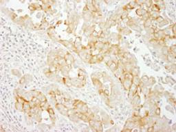 Detection of human Notch2 by immunohistochemistry.