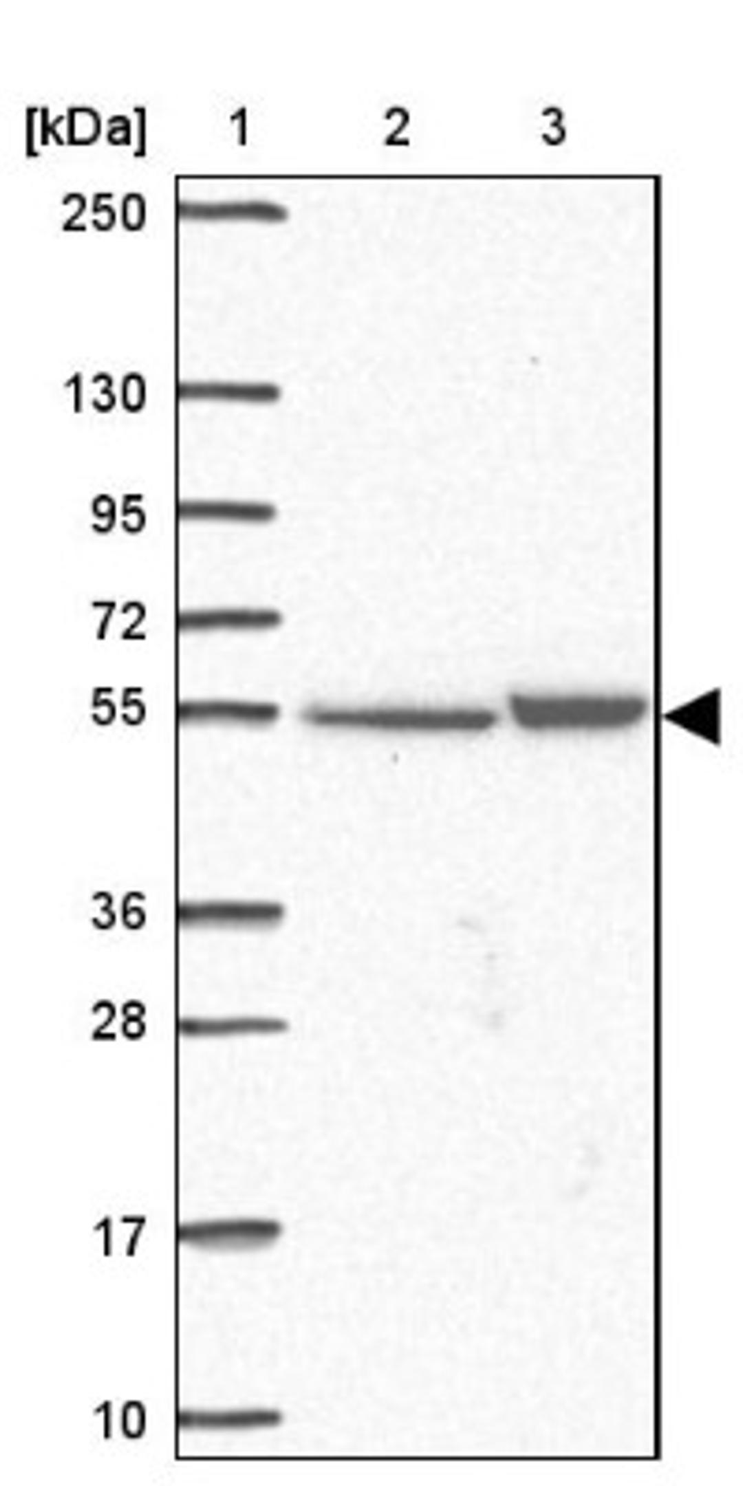 Western Blot: TMEM246 Antibody [NBP2-33702] - Lane 1: Marker [kDa] 250, 130, 95, 72, 55, 36, 28, 17, 10<br/>Lane 2: Human cell line RT-4<br/>Lane 3: Human cell line U-251MG sp