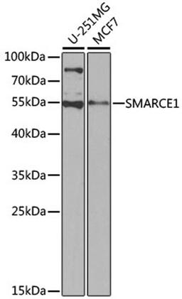 Western blot - SMARCE1 antibody (A13353)