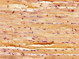 Immunohistochemistry of paraffin-embedded human skeletal muscle tissue using CSB-PA007314LA01HU at dilution of 1:100