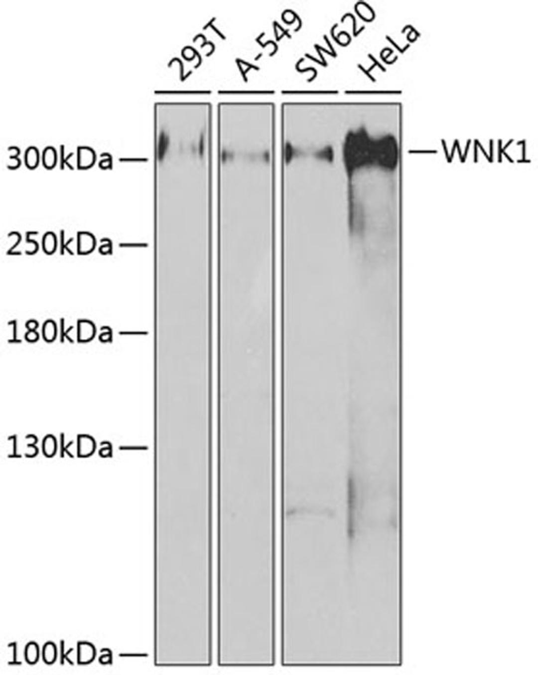 Western blot - WNK1 antibody (A2569)