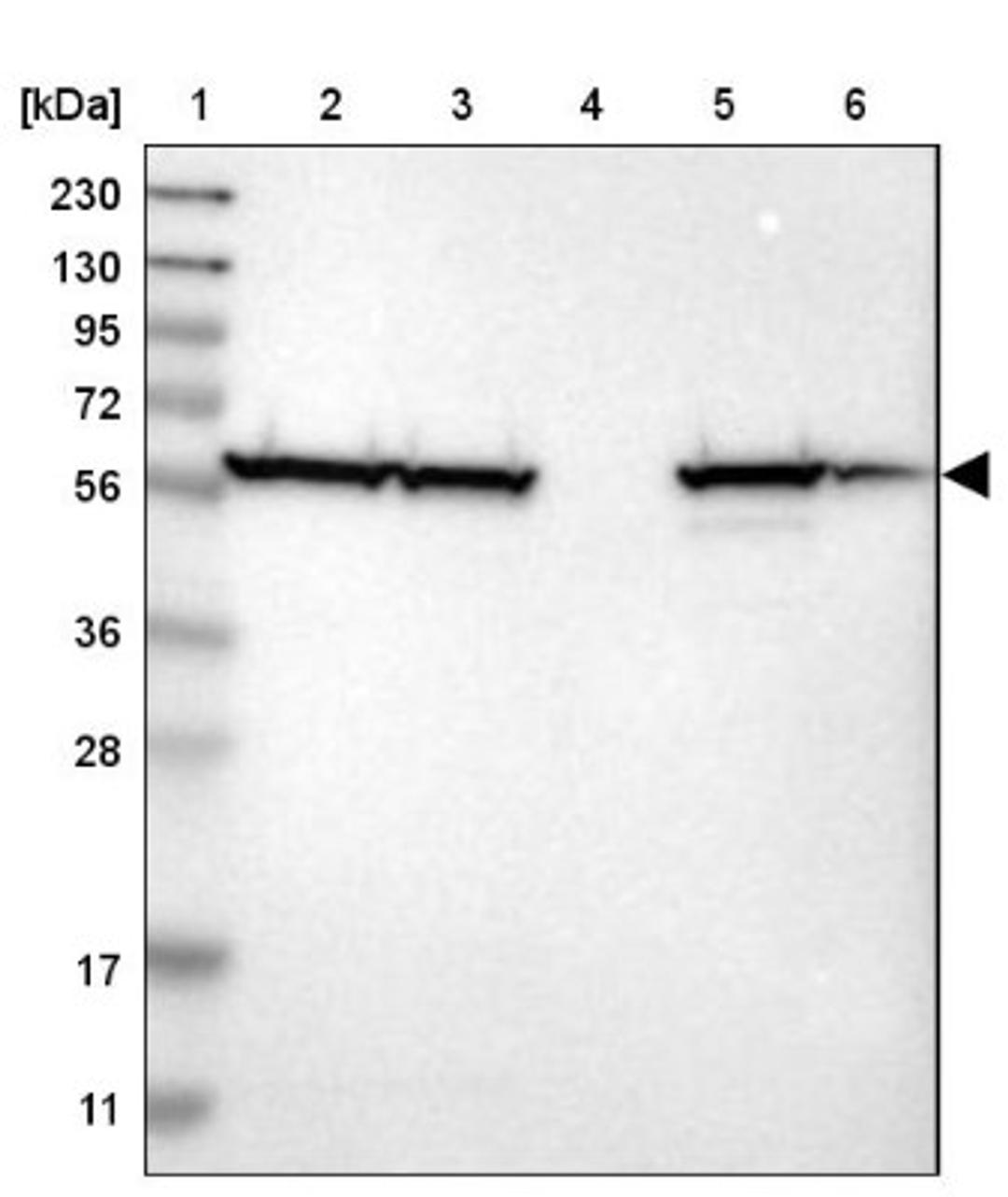 Western Blot: Splicing Factor 1 Antibody [NBP1-86835] - Lane 1: Marker [kDa] 230, 130, 95, 72, 56, 36, 28, 17, 11<br/>Lane 2: Human cell line RT-4<br/>Lane 3: Human cell line U-251MG sp<br/>Lane 4: Human plasma (IgG/HSA depleted)<br/>Lane 5: Human liver tissue<br/>Lane 6: Human tonsil tissue