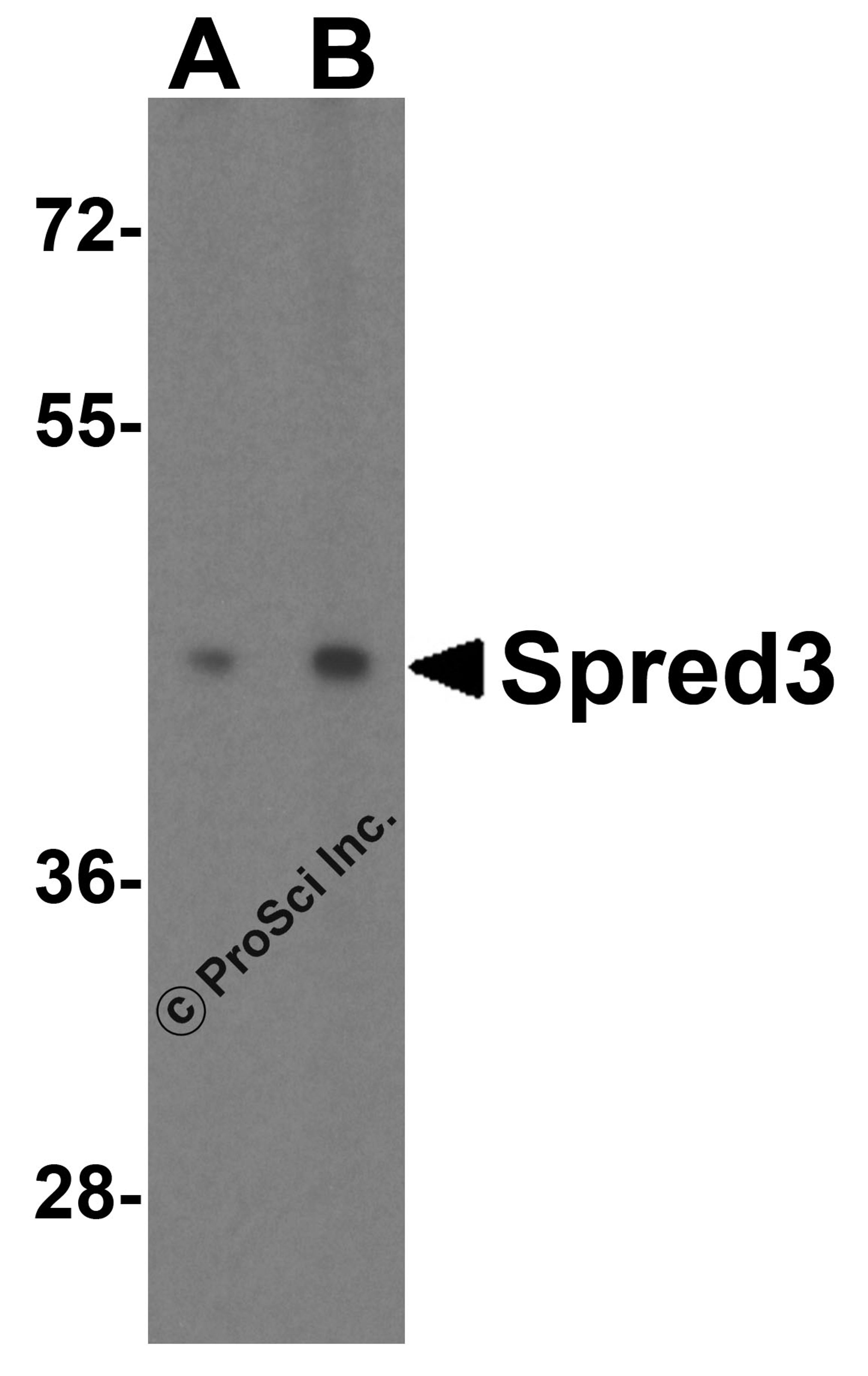 Western blot analysis of Spred3 in mouse brain tissue lysate with Spred3 antibody at (A) 2 and (B) 4 μg/mL.
