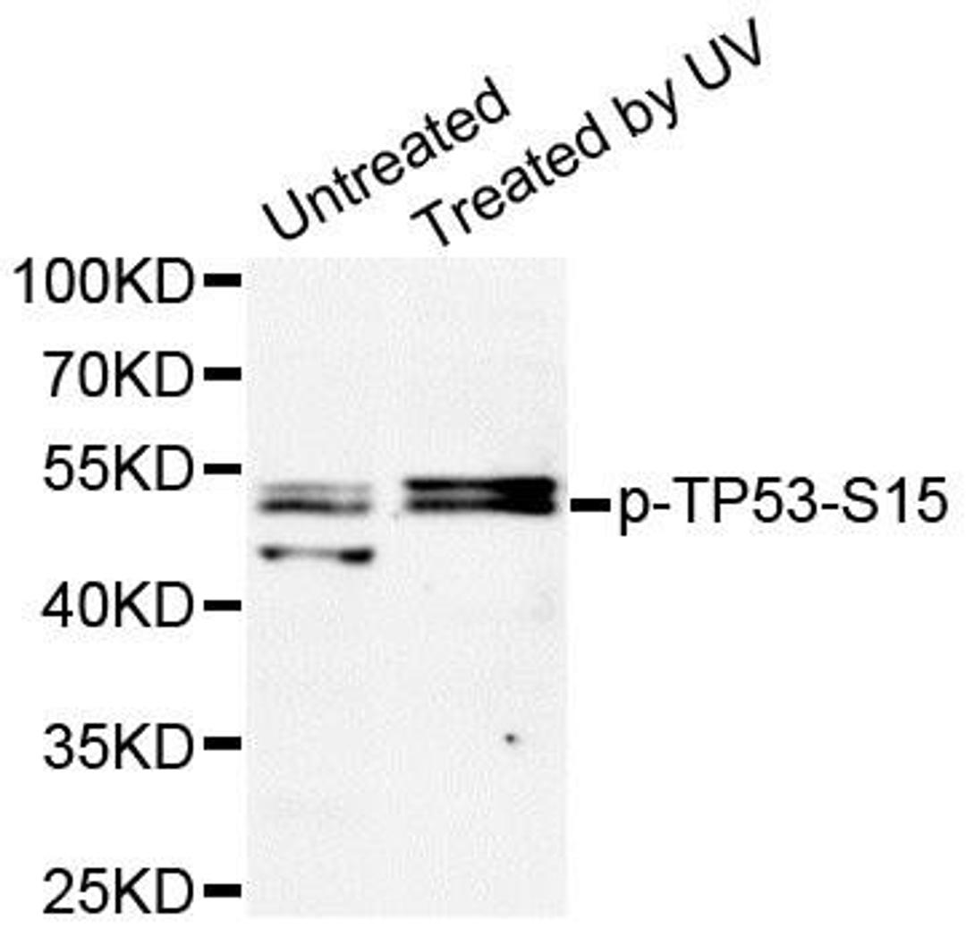 Western blot analysis of extracts of HT-29 cell line using p53 (phospho-Ser15) antibody