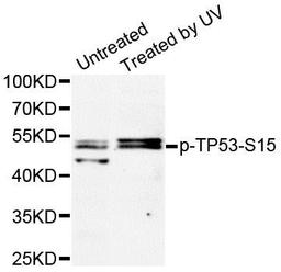 Western blot analysis of extracts of HT-29 cell line using p53 (phospho-Ser15) antibody