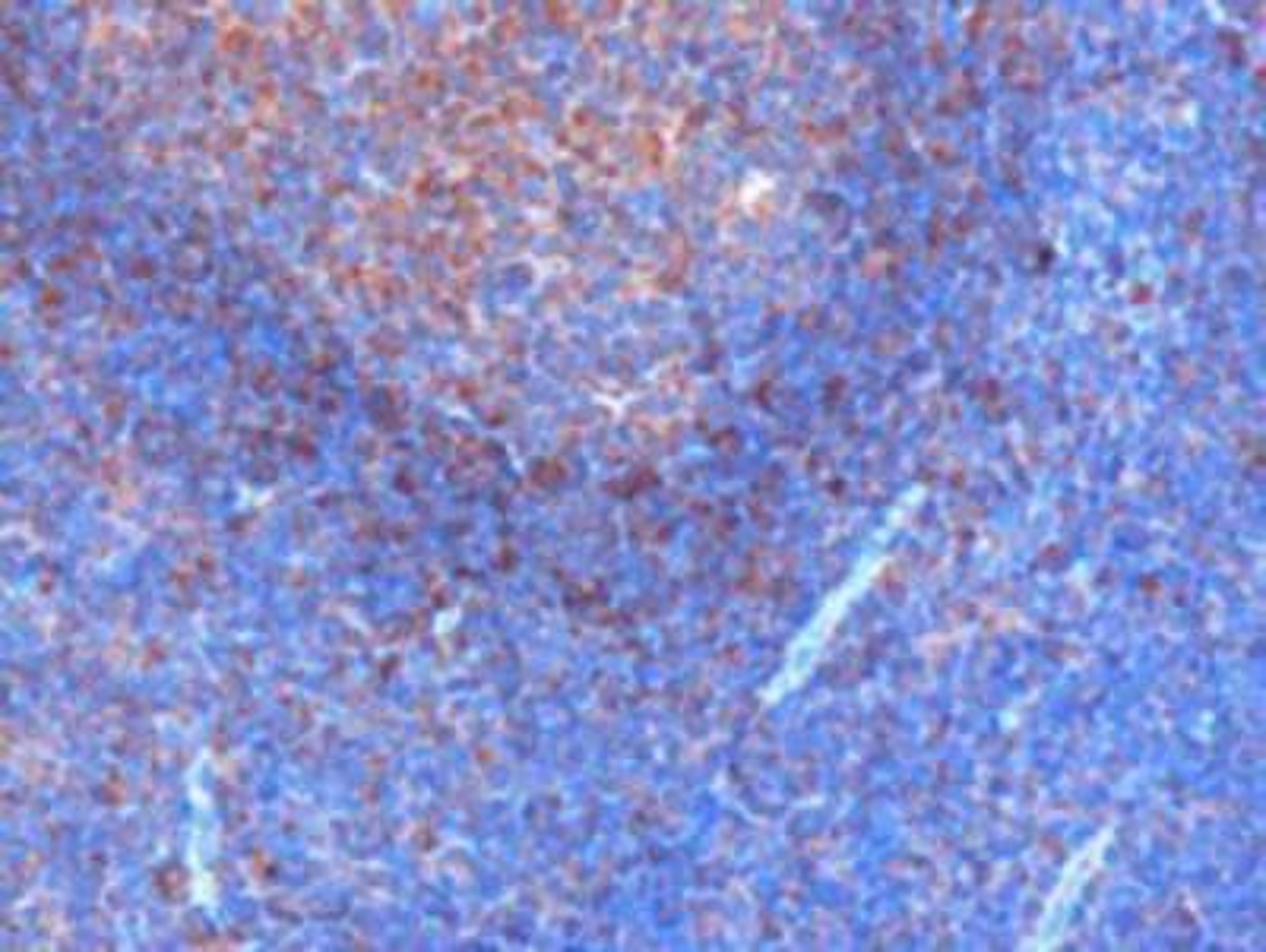 Immunohistochemistry-Paraffin: GRB2 Antibody [NB100-866] - Analysis of human tonsil. Microwaved antigen retrieval with citrate buffer pH6, HRP-staining.