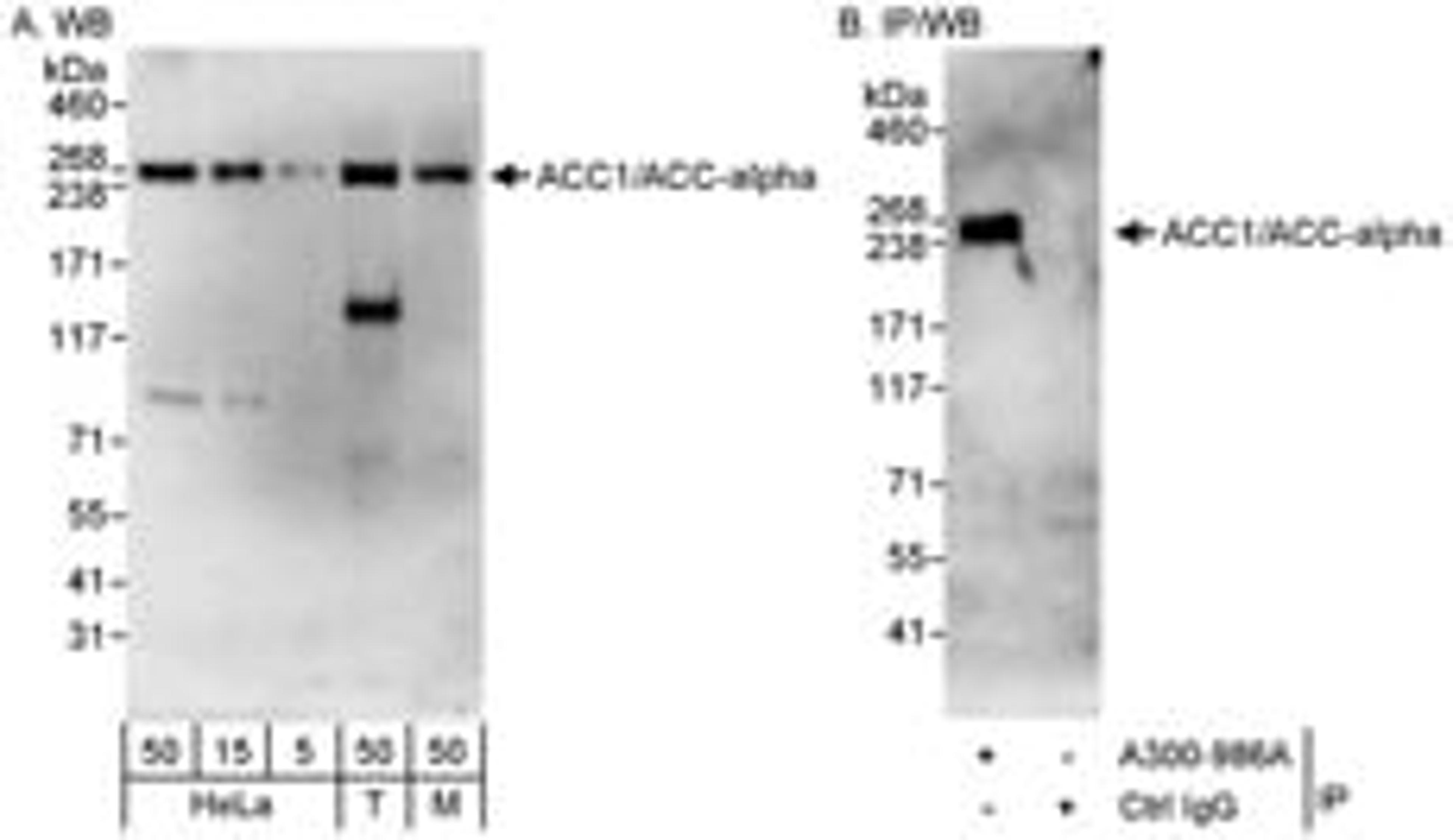 Detection of human and mouse ACC1/ACC-alpha by western blot (h&m) and immunoprecipitation (h).