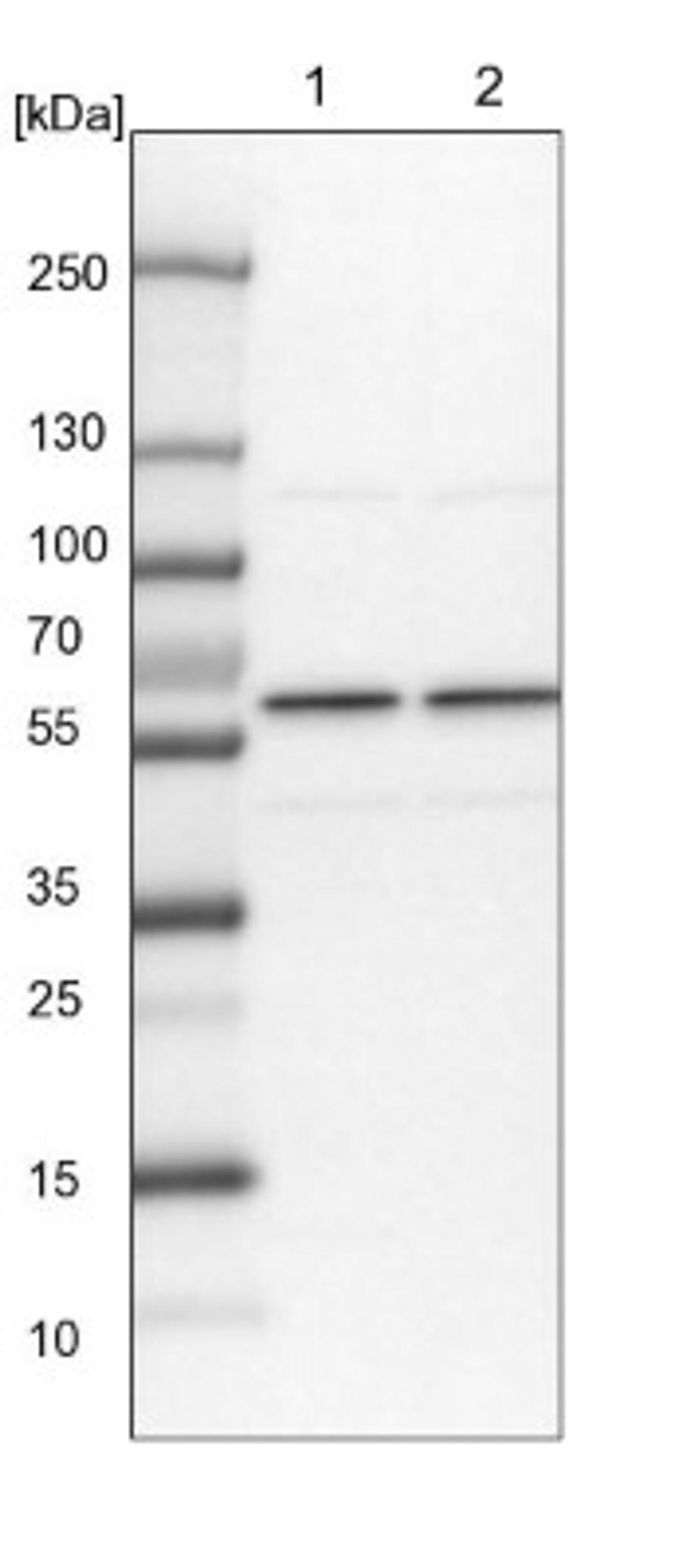 Western Blot: SF3A3 Antibody [NBP1-87212] - Lane 1: NIH-3T3 cell lysate (Mouse embryonic fibroblast cells)<br/>Lane 2: NBT-II cell lysate (Rat Wistar bladder tumour cells)