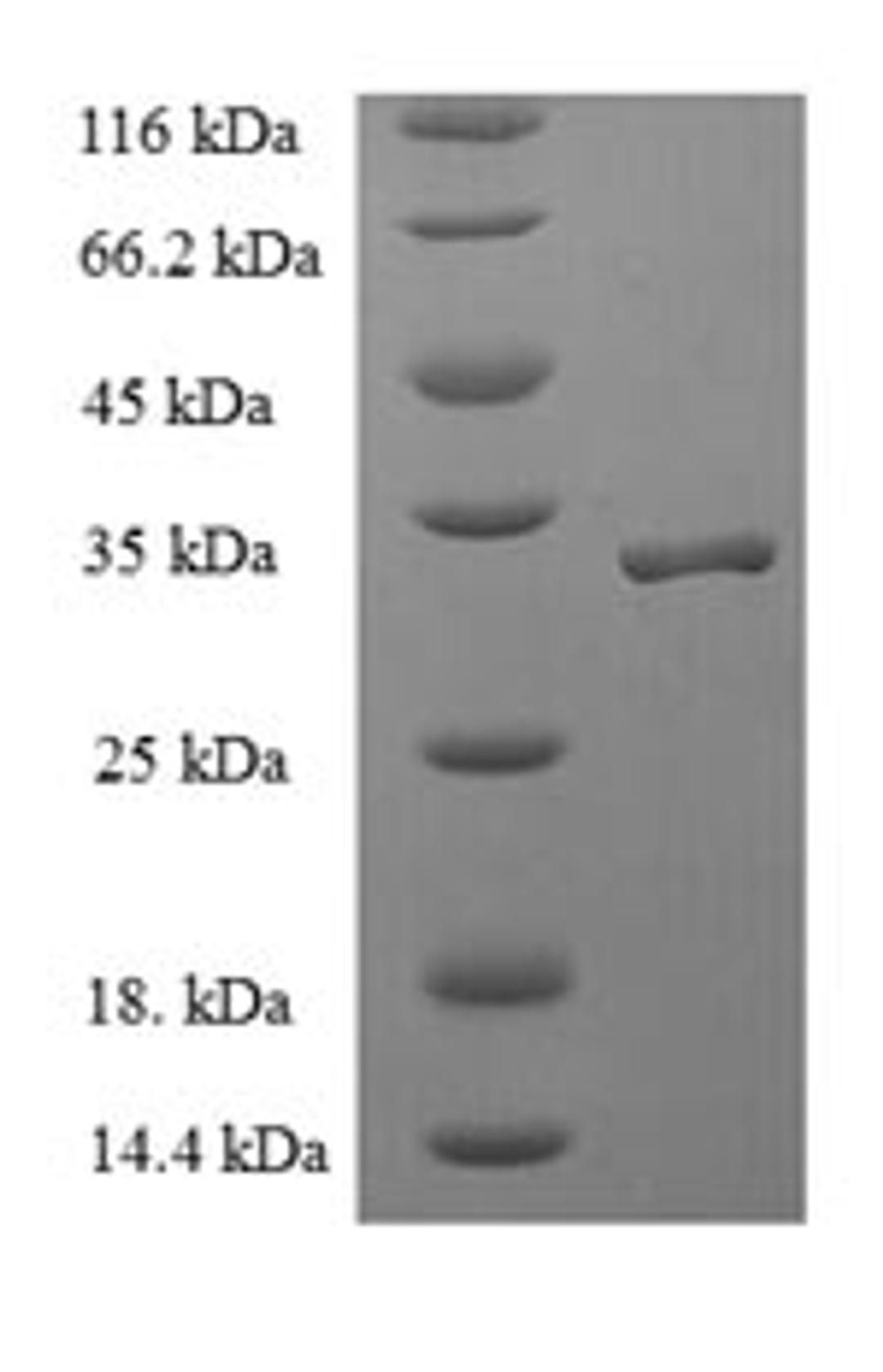 (Tris-Glycine gel) Discontinuous SDS-PAGE (reduced) with 5% enrichment gel and 15% separation gel.