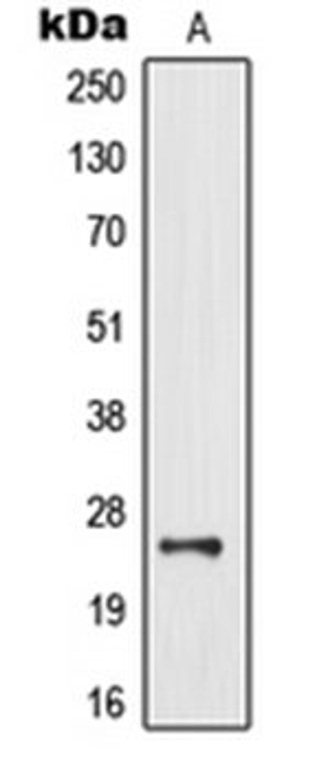 Western blot analysis of human brain (Lane 1) whole cell lysates using MOB3B antibody