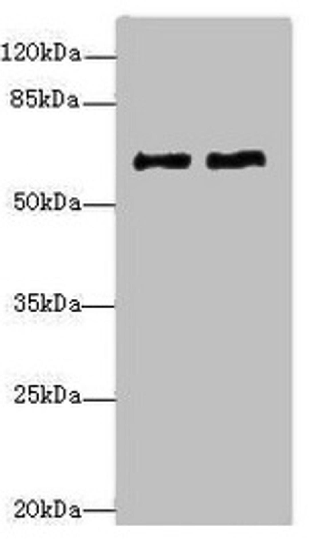Western blot. All lanes: COL9A3antibody at 1.36ug/ml. Lane 1: MCF-7 whole cell lysate. Lane 2: A549 whole cell lysate. Secondary. Goat polyclonal to rabbit IgG at 1/10000 dilution. Predicted band size: 64 kDa. Observed band size: 64 kDa. 