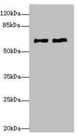 Western blot. All lanes: COL9A3antibody at 1.36ug/ml. Lane 1: MCF-7 whole cell lysate. Lane 2: A549 whole cell lysate. Secondary. Goat polyclonal to rabbit IgG at 1/10000 dilution. Predicted band size: 64 kDa. Observed band size: 64 kDa. 