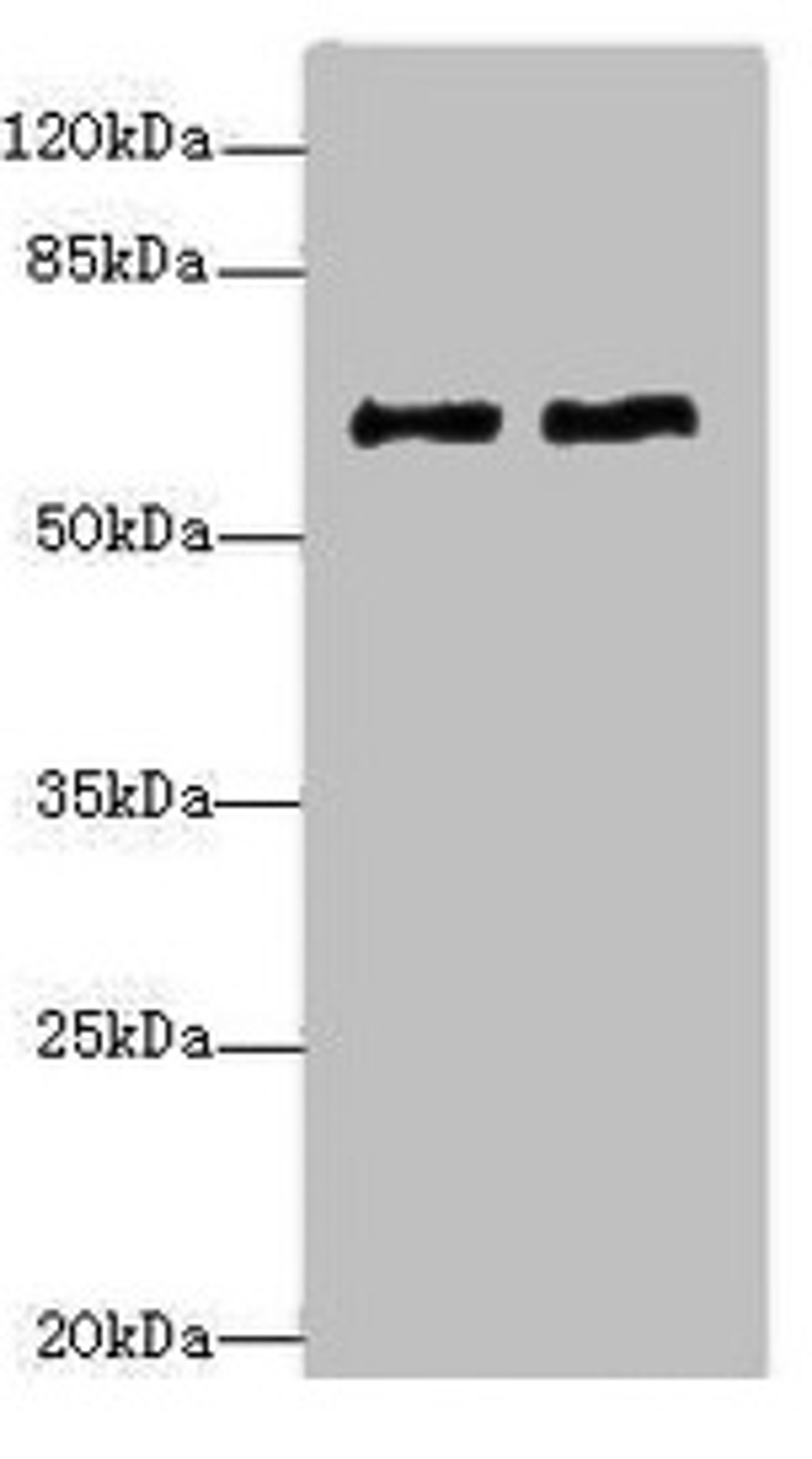 Western blot. All lanes: COL9A3antibody at 1.36ug/ml. Lane 1: MCF-7 whole cell lysate. Lane 2: A549 whole cell lysate. Secondary. Goat polyclonal to rabbit IgG at 1/10000 dilution. Predicted band size: 64 kDa. Observed band size: 64 kDa. 
