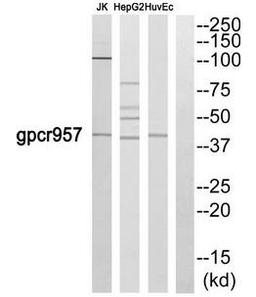 Western blot analysis of JK cells HepG2 cells and HuvEc cells using US28 antibody.