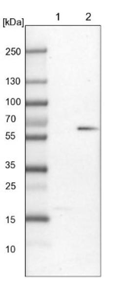 Western Blot: CaMKV Antibody [NBP1-82660] - Lane 1: Mouse liver tissue lysate<br/>Lane 2: Rat liver tissue lysate