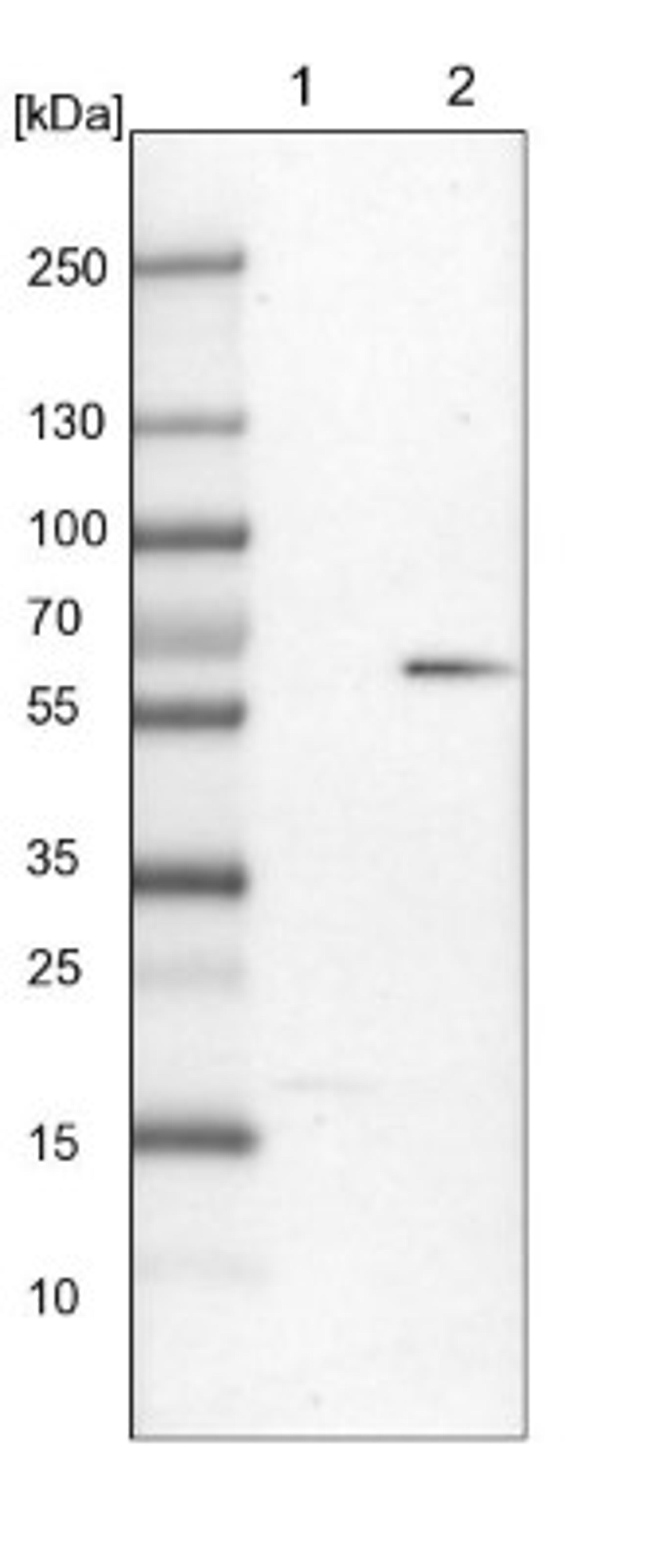 Western Blot: CaMKV Antibody [NBP1-82660] - Lane 1: Mouse liver tissue lysate<br/>Lane 2: Rat liver tissue lysate