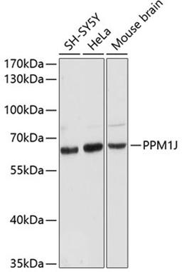 Western blot - PPM1J antibody (A12844)