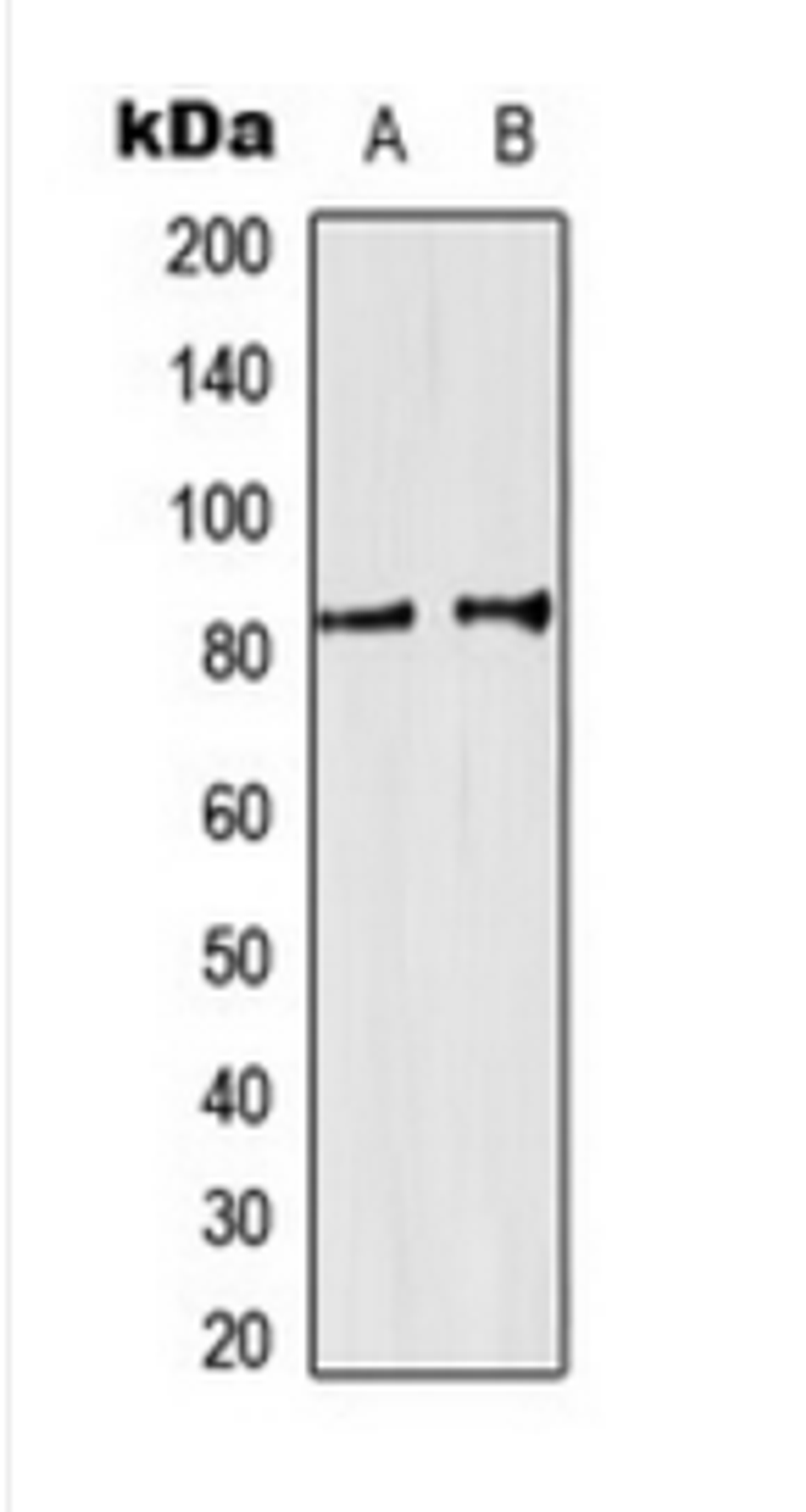 Western blot analysis of HeLa (Lane 1), K562 (Lane 2) whole cell lysates using SP3/4 antibody