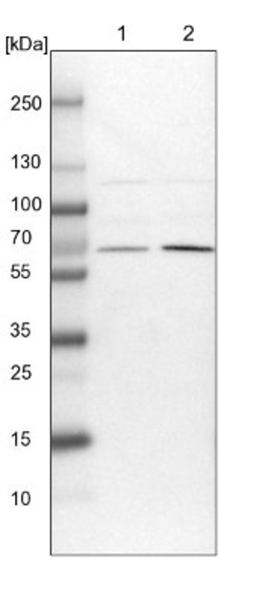 Western Blot: UBXD2 Antibody [NBP1-92560] - Lane 1: NIH-3T3 cell lysate (Mouse embryonic fibroblast cells)<br/>Lane 2: NBT-II cell lysate (Rat Wistar bladder tumour cells)