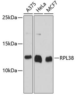 Western blot - RPL38 antibody (A12038)