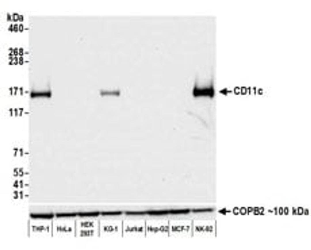 Detection of human CD11c by western blot.