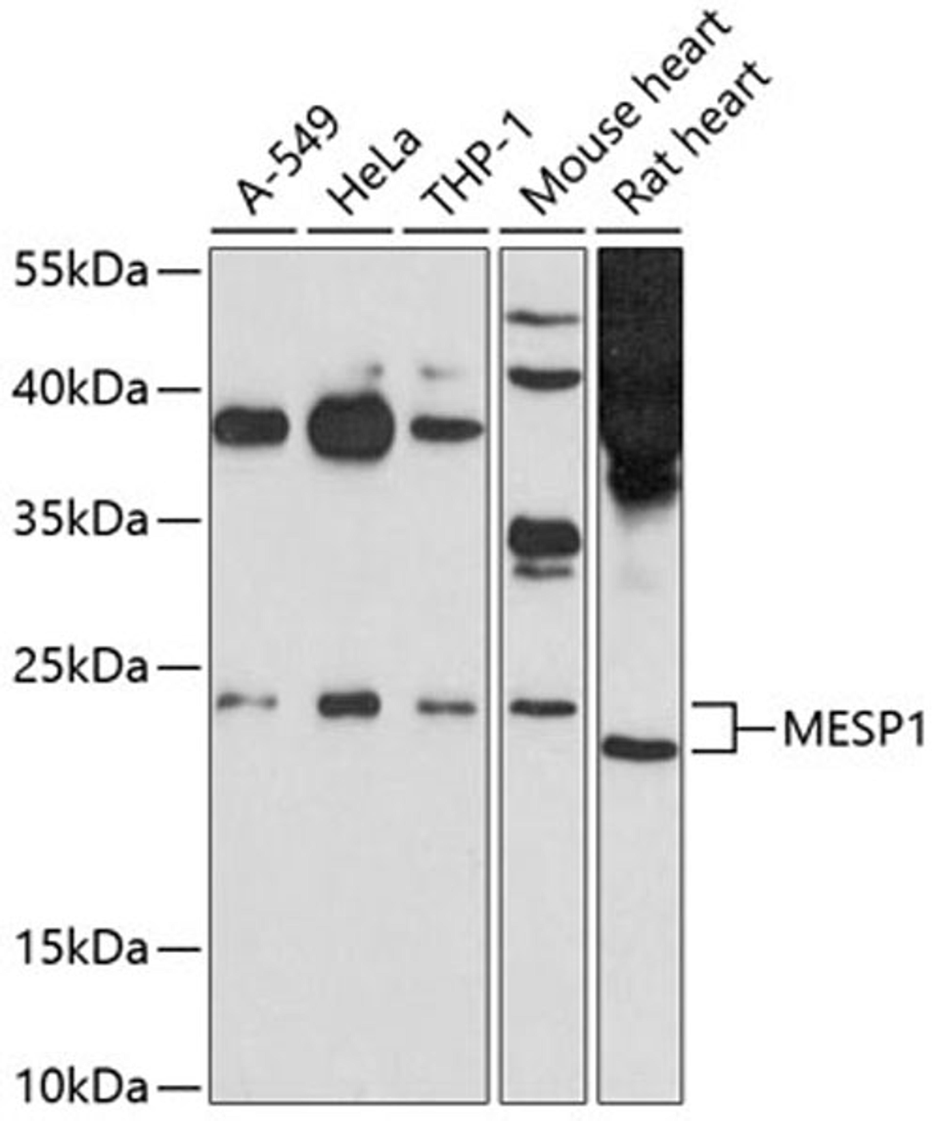 Western blot - MESP1 antibody (A10148)