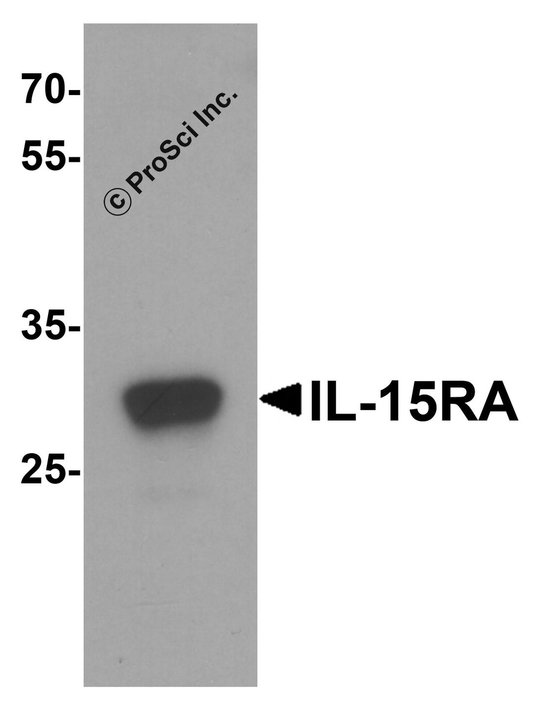 Western blot analysis of IL-15RA in rat small intestine tissue lysate with IL-15RA antibody at 1 μg/mL.