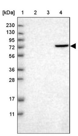 Western Blot: HABP2 Antibody [NBP1-83419] - Lane 1: Marker [kDa] 230, 130, 95, 72, 56, 36, 28, 17, 11<br/>Lane 2: Human cell line RT-4<br/>Lane 3: Human cell line U-251MG sp<br/>Lane 4: Human plasma (IgG/HSA depleted)