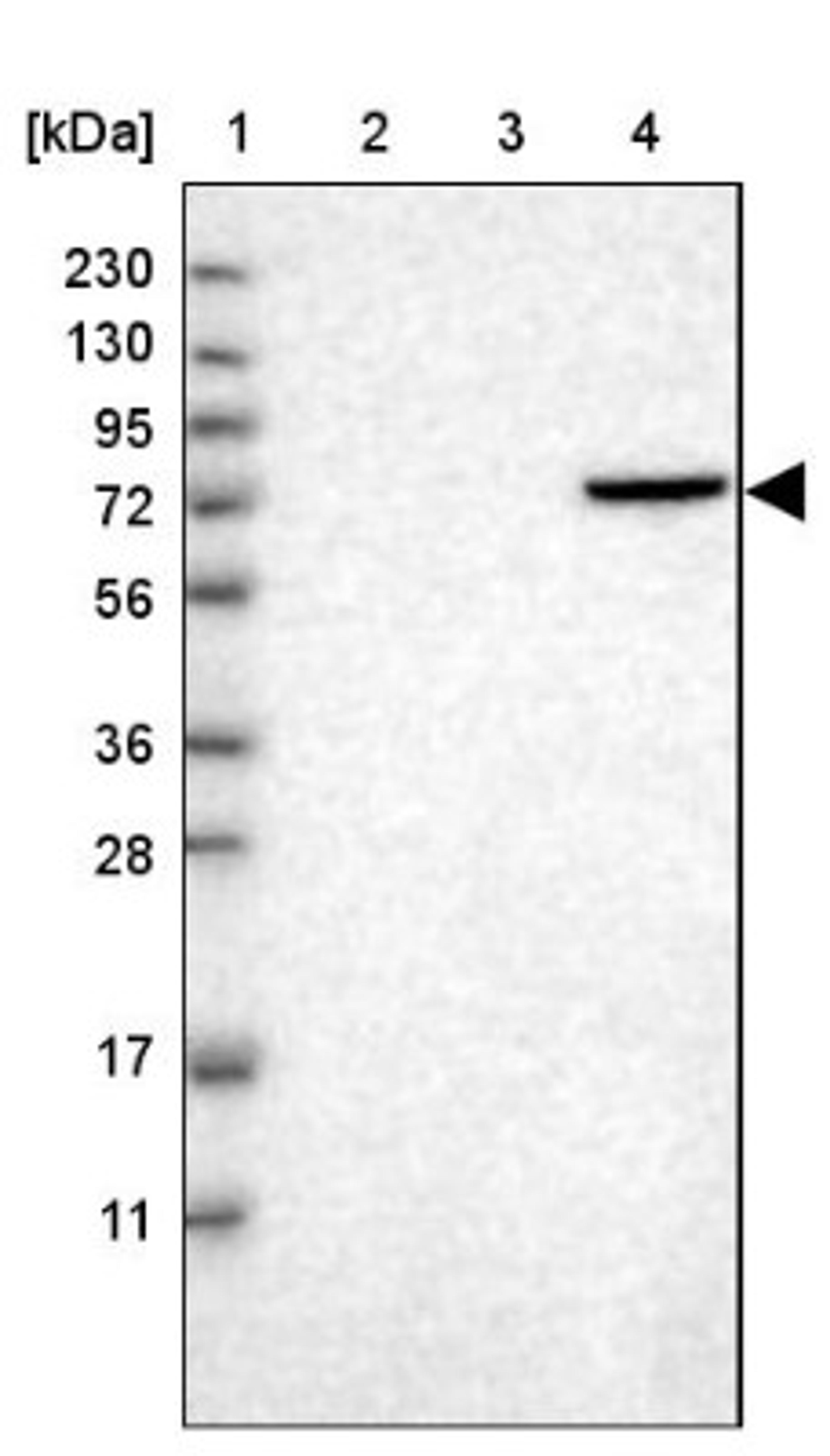 Western Blot: HABP2 Antibody [NBP1-83419] - Lane 1: Marker [kDa] 230, 130, 95, 72, 56, 36, 28, 17, 11<br/>Lane 2: Human cell line RT-4<br/>Lane 3: Human cell line U-251MG sp<br/>Lane 4: Human plasma (IgG/HSA depleted)