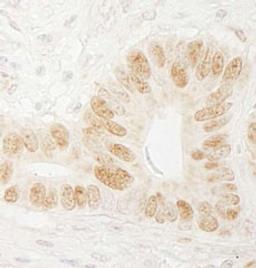 Detection of human CTF18 by immunohistochemistry.