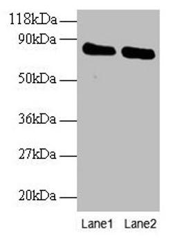 Western blot. All lanes: OTUB1 antibody at 2µg/ml. Lane 1: EC109 whole cell lysate. Lane 2: 293T whole cell lysate. Secondary. Goat polyclonal to rabbit IgG at 1/15000 dilution. Predicted band size: 32, 36 kDa. Observed band size: 80 kDa